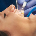 What are common dental procedures?
