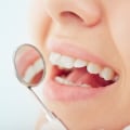 What is Good Dental Health