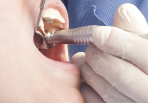 Do you get free dental treatment on universal credit northern ireland?