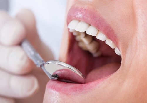 What are the Basics of Dental Care